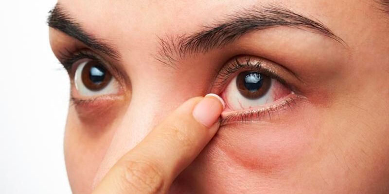 Ngứa mắt thường xuyên sử dụng máy massage mắt